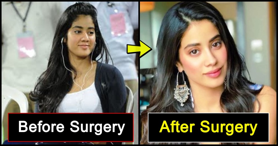 9 celebrities who changed dramatically after 'Plastic Surgery', details inside