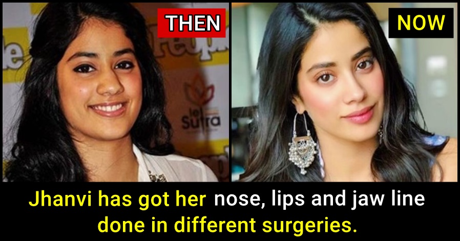 Jhanvi Kapoor will be very upset after Sonam Kapoor's take on Plastic Surgery