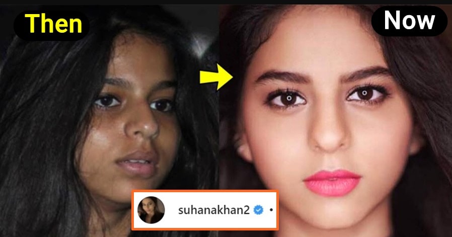 Suhana Khan Slams People For Mocking Her Skin Colour, check out her reply!