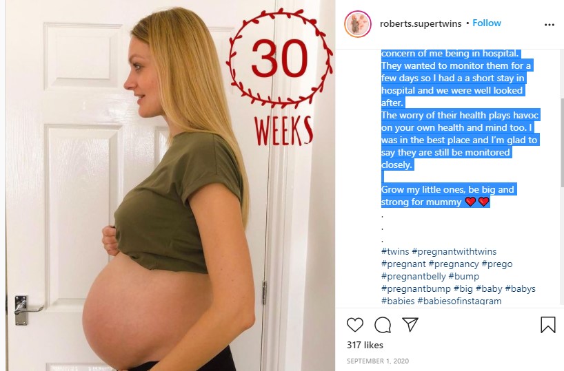 UK woman got pregnant while already 3 weeks pregnant, read her story in detail