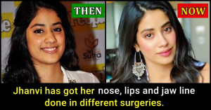 Sonam Kapoor made a harsh statement on actresses who underwent 'Plastic Surgery', read details