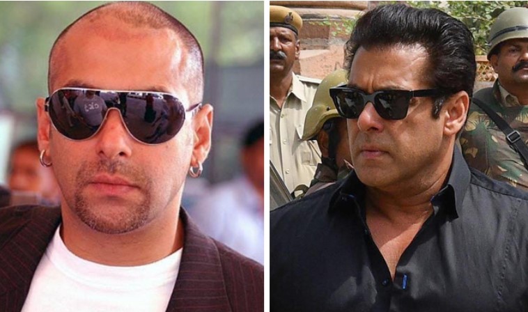 5 Bollywood Celebs Whose Career Changed Drastically After Getting Hair Transplant