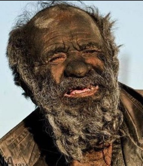 World's Dirtiest Man dies shortly after taking first bath in over 60 years, read details