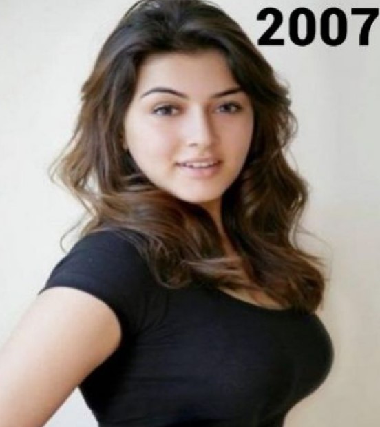 Hansika Motwani Took Hormonal Injection At The Age Of 16 To Become Adult