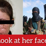 Meet the woman who was s*x slave in ISIS camps, that's how she looks after the agony