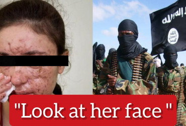 Meet the woman who was s*x slave in ISIS camps, that's how she looks after the agony