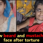 Husband tortures and beats wife for year, and gives injection to change her gender