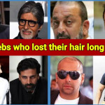 10 Indian stars who lost their hair, now using artificial techniques to cover it