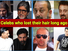 10 Indian stars who lost their hair, now using artificial techniques to cover it