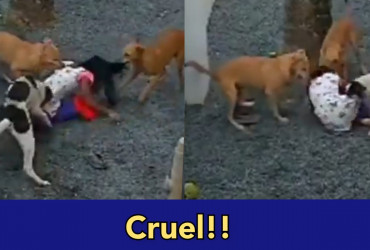 Street dogs kill a very small kid, where are dog lovers now?