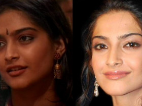 Sonam Kapoor's take on actress undergoing ‘Plastic Surgeries’ goes viral