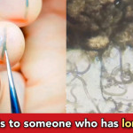 Viral Video: millions of bacteria reside inside your nail- check it out
