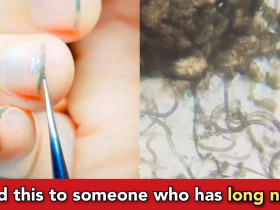 Viral Video: millions of bacteria reside inside your nail- check it out